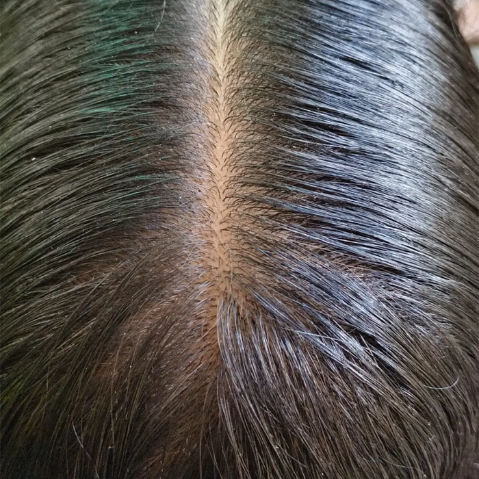 After